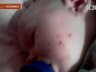 В Колпино от зубов грызуна пострадал десятимесячный малыш